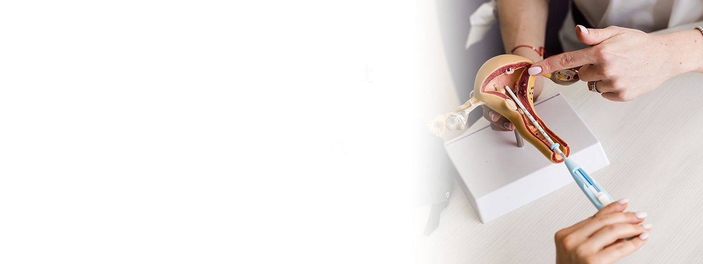 IUI Treatment Explained: What You Need to Know Before Starting